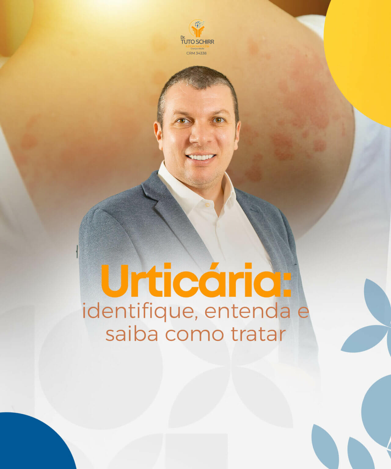 Urticária Identifique, Entenda e Saiba Como Tratar Dr. Luis Schirr
